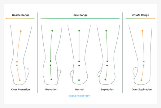 プロネーション、オーバープロネーション、スピネーションとは？
